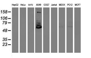 m09384 anti tulp3 mouse monoclonal antibody clone id oti4e5 wb testing 2