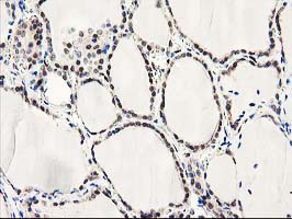 m09395 1 anti lxn mouse monoclonal antibody clone id oti2g4 ihc testing 5
