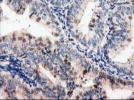 m09395 1 anti lxn mouse monoclonal antibody clone id oti2g4 ihc testing 7