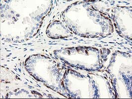 m09395 1 anti lxn mouse monoclonal antibody clone id oti2g4 ihc testing 8