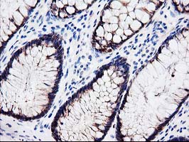 m09395 1 anti lxn mouse monoclonal antibody clone id oti2g4 ihc testing 9