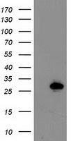 HEK293T cells were transfected with the pCMV6-ENTRY control (Left lane) or pCMV6-ENTRY LXN (Right lane) cDNA for 48 hrs and lysed