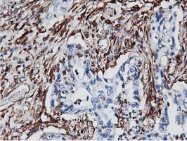 m09395 anti lxn mouse monoclonal antibody clone id oti1e10 ihc testing 5