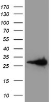 HEK293T cells were transfected with the pCMV6-ENTRY control (Left lane) or pCMV6-ENTRY LXN (Right lane) cDNA for 48 hrs and lysed