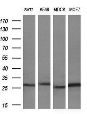 Western blot analysis of extracts (10ug) from 4 different cell lines by using anti-LXN monoclonal antibody (1:200)
