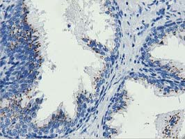 Immunohistochemical staining of paraffin-embedded Human prostate tissue within the normal limits using anti-MOBKL1A mouse monoclonal antibody (M09405) at 1:150 dilution