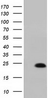 HEK293T cells were transfected with the pCMV6-ENTRY control (Left lane) or pCMV6-ENTRY MOBKL1A (Right lane) cDNA for 48 hrs and lysed