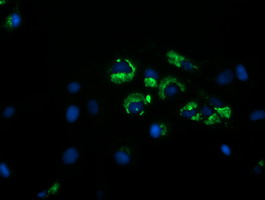 Anti-GORAB mouse monoclonal antibody (M09417) immunofluorescent staining of COS7 cells transiently transfected by pCMV6-ENTRY GORAB