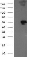 HEK293T cells were transfected with the pCMV6-ENTRY control (Left lane) or pCMV6-ENTRY GORAB (Right lane) cDNA for 48 hrs and lysed