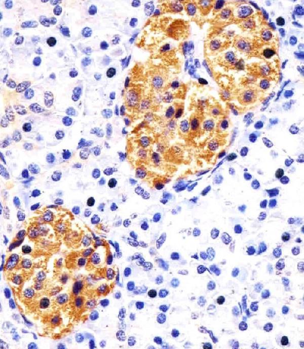 M09431 staining RAB3B in human pancreas sections by Immunohistochemistry (IHC-P -paraformaldehyde-fixed, paraffin-embedded sections). Tissue was fixed with formaldehyde and blocked with 3% BSA for 0. 5 hour at room temperature; antigen retrieval was by heat mediation with a citrate buffer (pH6). Samples were incubated with primary antibody (1/25) for 1 hours at 37°C. A undiluted biotinylated goat polyvalent antibody was used as the secondary antibody.