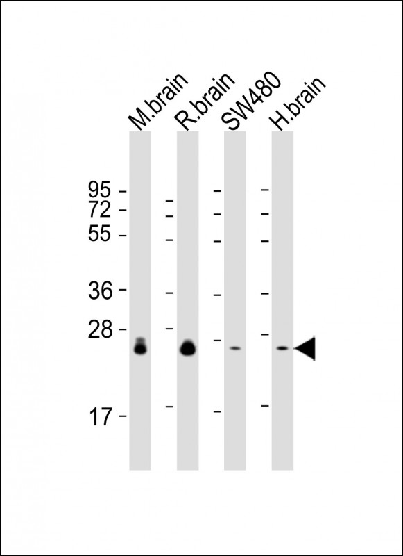 All lanes : Anti-RAB3B Antibody at 1:2000 dilution Lane 1: mouse brain lysate Lane 2: rat brain lysate Lane 3: SW480 whole cell lysate Lane 4: human brain lysate Lysates/proteins at 20 microg per lane. Secondary Goat Anti-mouse IgG, (H+L), Peroxidase conjugated at 1/10000 dilution. Predicted band size : 25 kDa Blocking/Dilution buffer: 5% NFDM/TBST.