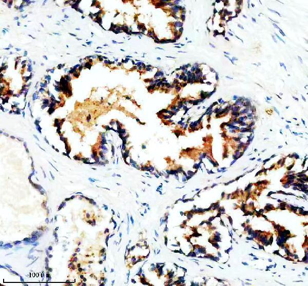 IHC analysis of UAP1 using anti-UAP1 antibody (M09450-1)