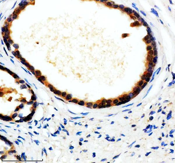 IHC analysis of UAP1 using anti-UAP1 antibody (M09450-1)