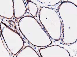 Immunohistochemical staining of paraffin-embedded Human thyroid tissue within the normal limits using anti-FAM40A mouse monoclonal antibody