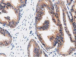 m09470 anti fam40a strip1 mouse monoclonal antibody clone id oti7b8 ihc testing 5