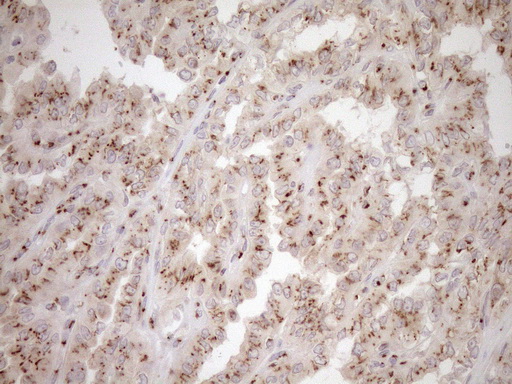 m09474 anti trim56 mouse monoclonal antibody clone id oti5a1 ihc testing 2