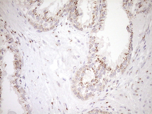 m09474 anti trim56 mouse monoclonal antibody clone id oti5a1 ihc testing 3