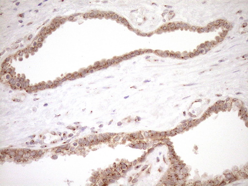 m09474 anti trim56 mouse monoclonal antibody clone id oti5a1 ihc testing 4