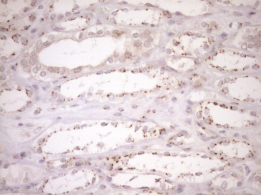m09474 anti trim56 mouse monoclonal antibody clone id oti5a1 ihc testing 6