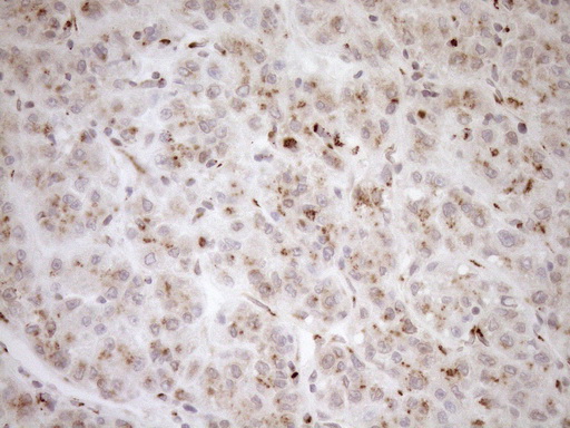 m09474 anti trim56 mouse monoclonal antibody clone id oti5a1 ihc testing 7
