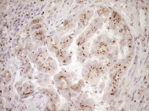 m09474 anti trim56 mouse monoclonal antibody clone id oti5a1 ihc testing 8