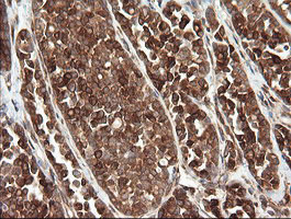 m09482 anti tapasin related protein tapbpl mouse monoclonal antibody clone id oti4h5 ihc testing 4