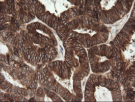 m09482 anti tapasin related protein tapbpl mouse monoclonal antibody clone id oti4h5 ihc testing 5