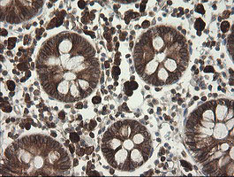m09482 anti tapasin related protein tapbpl mouse monoclonal antibody clone id oti4h5 ihc testing 7