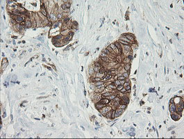 m09482 anti tapasin related protein tapbpl mouse monoclonal antibody clone id oti4h5 ihc testing 8