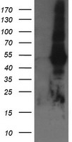 HEK293T cells were transfected with the pCMV6-ENTRY control (Left lane) or pCMV6-ENTRY TAPBPL (Right lane) cDNA for 48 hrs and lysed