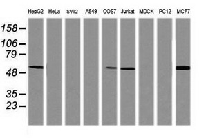 Western blot analysis of extracts (35ug) from 9 different cell lines by usin g anti-TAPBPL monoclonal antibody (HepG2: human; HeLa: human; SVT2: mouse; A549: human; COS7: monkey; Jurkat: human; MDCK: canine; PC12: rat; MCF7: human)