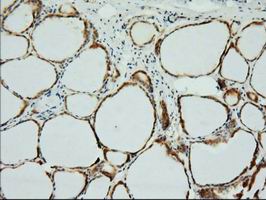 Immunohistochemical staining of paraffin-embedded Human thyroid tissue within the normal limits using anti-XPNPEP1 mouse monoclonal antibody