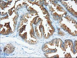 m09499 anti xpnpep1 mouse monoclonal antibody clone id oti1e3 ihc testing 4