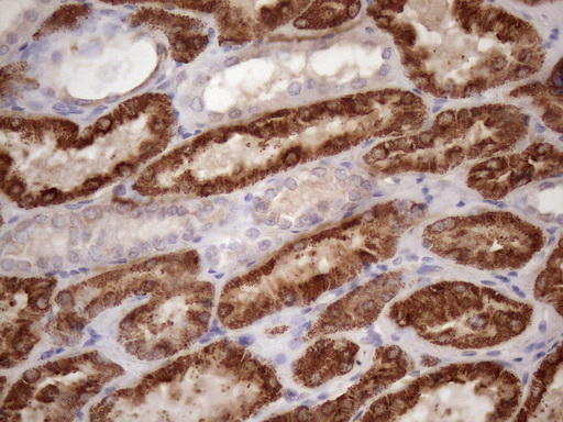 m09506 anti glyat mouse monoclonal antibody clone id oti4d1 ihc testing 2