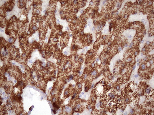m09506 anti glyat mouse monoclonal antibody clone id oti4d1 ihc testing 3
