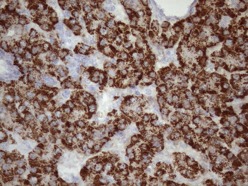 m09506 anti glyat mouse monoclonal antibody clone id oti4d1 ihc testing 4