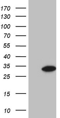 m09506 anti glyat mouse monoclonal antibody clone id oti4d1 wb testing 1