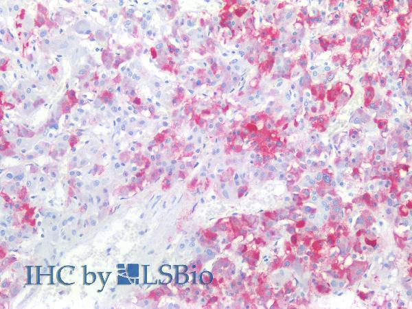 Immunohistochemistry staining of human adrenal gland (paraffin-embedded sections) with anti-CD57 (TB01), 10 µg/ml