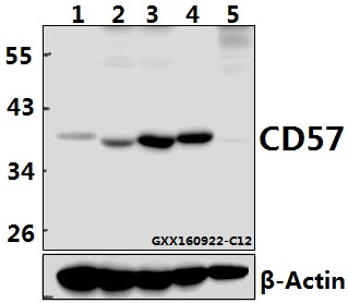 Western blot (WB) analysis of CD57 mAb at 1:500 dilution
Lane1:U-87MG whole cell lysate(40ug)
Lane2:The Brain tissue lysate of Mouse(40ug)
Lane3:The Brain tissue lysate of Rat(40ug)
Lane4:C6 whole cell lysate(40ug)
Lane5:The Heart tissue lysate of Mouse(40ug)
