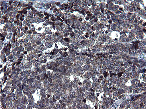 m09549 anti hscb mouse monoclonal antibody clone id oti3e1 ihc testing 7
