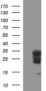 HEK293T cells were transfected with the pCMV6-ENTRY control (Left lane) or pCMV6-ENTRY HSCB (Right lane) cDNA for 48 hrs and lysed