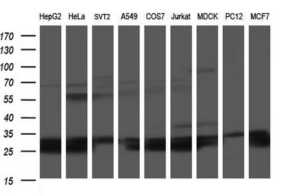 Western blot analysis of extracts (35ug) from 9 different cell lines by using anti-HSCB monoclonal antibody (HepG2: human; HeLa: human; SVT2: mouse; A549: human; COS7: monkey; Jurkat: human; MDCK: canine; PC12: rat; MCF7: human)