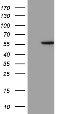 m09556 anti aldh3b1 mouse monoclonal antibody clone id oti2f6 wb testing 1
