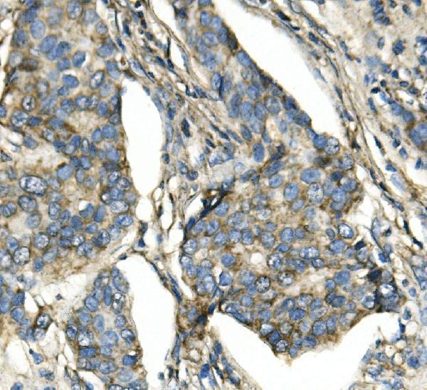 m09565 atp5h primary antibodies ihc testing 3_1