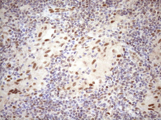m09601 anti tceal1 mouse monoclonal antibody clone id oti2g10 ihc testing 11
