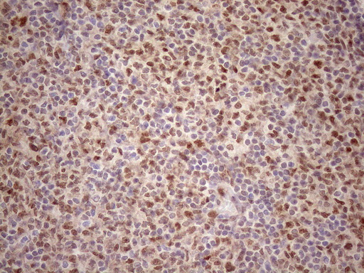 m09601 anti tceal1 mouse monoclonal antibody clone id oti2g10 ihc testing 12