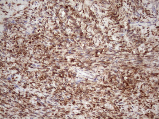m09601 anti tceal1 mouse monoclonal antibody clone id oti2g10 ihc testing 2