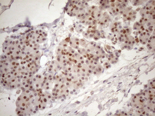 m09601 anti tceal1 mouse monoclonal antibody clone id oti2g10 ihc testing 3