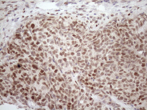 m09601 anti tceal1 mouse monoclonal antibody clone id oti2g10 ihc testing 6