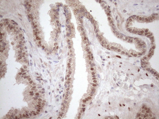 m09601 anti tceal1 mouse monoclonal antibody clone id oti2g10 ihc testing 8